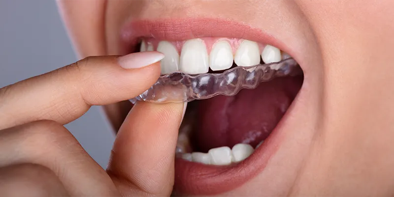 Ortodoncia dental